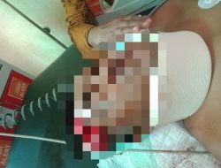 Hentikan Motor, Warga Besuk Tewas karena Mercon saat Berlebaran