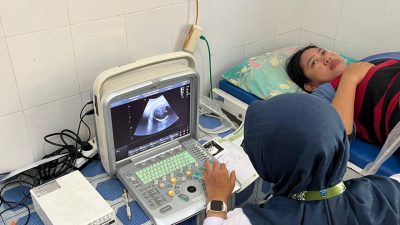 Wujudkan Pemerataan Layanan, Dinkes Kabupaten Probolinggo Boyong Dokter Spesialis Hingga X-Ray ke Pulau Gili Ketapang